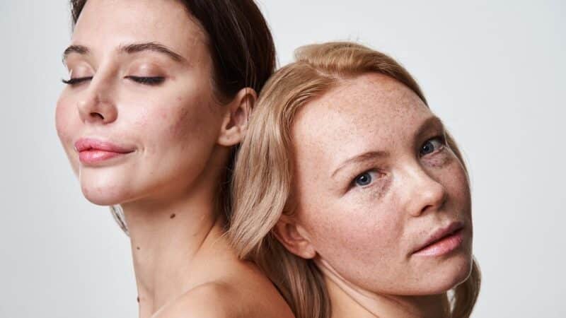 Jak spowolnić starzenie się skóry?
